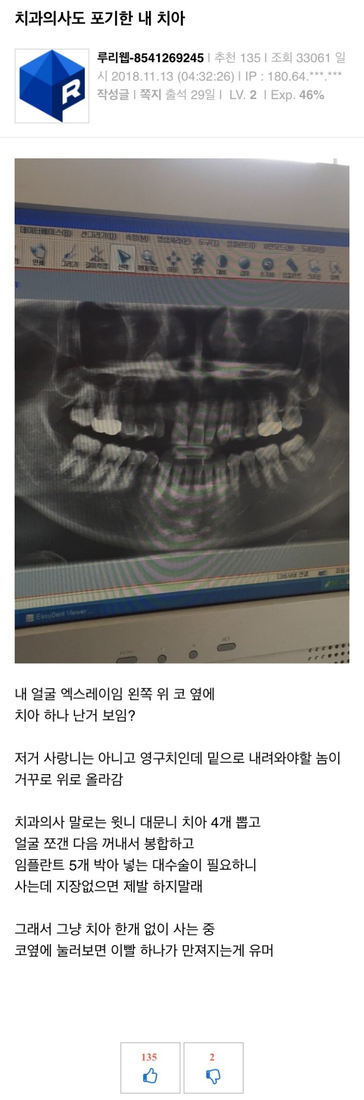 치과의사도 포기한 치아.jpg